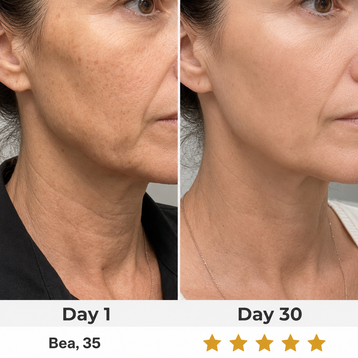 LumaLift - Advanced Face Lifting Wand