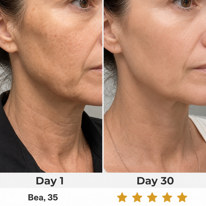 LumaLift - Advanced Face Lifting Wand