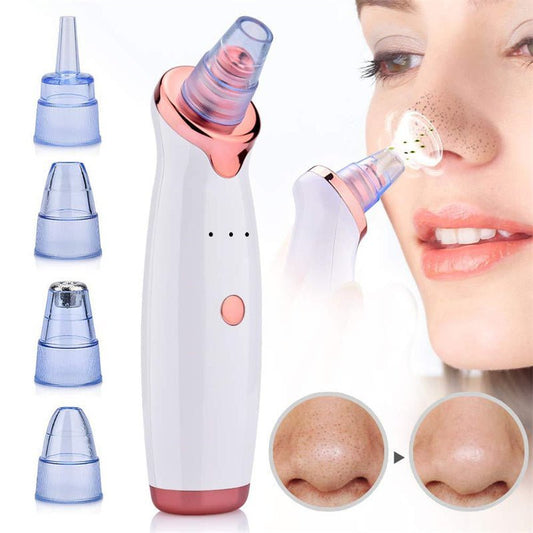 Electric BlackHead Remover - Prime Gift Ideas