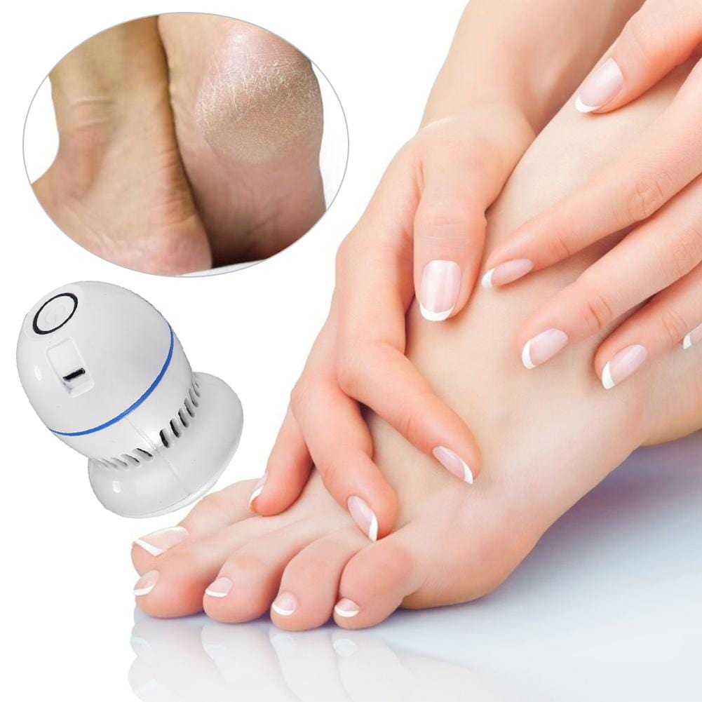 Electric Foot Grinder Vacuum Callus Remover - Prime Gift Ideas